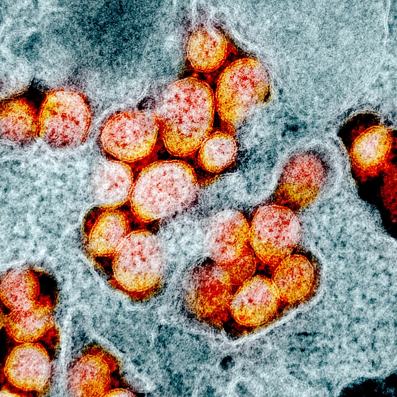 Colour-enhanced transmission electron micrograph showing round SARS-CoV-2 virus particles in orange and red, emerging from the surface of a cell shown in pale blue-grey.