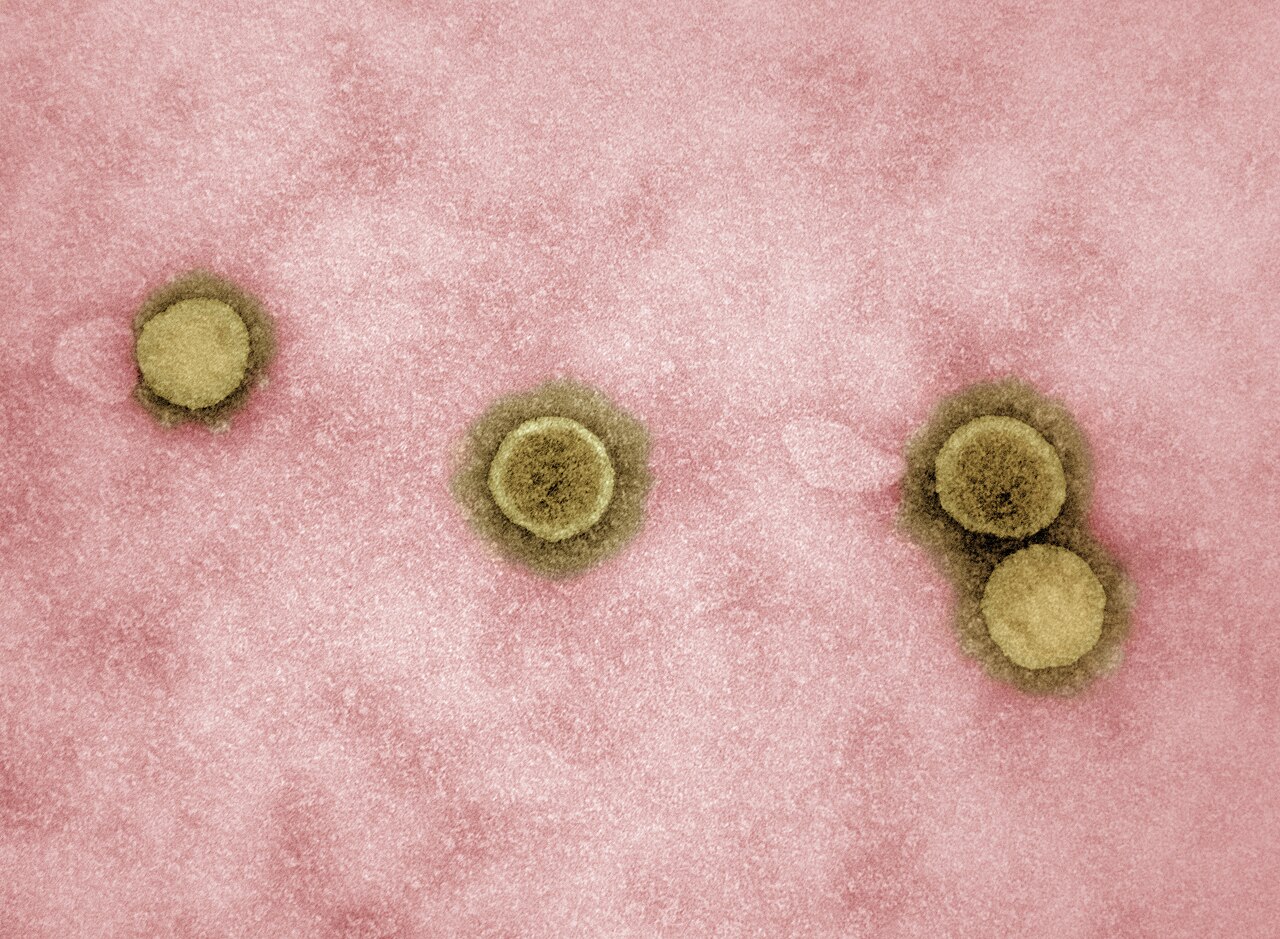Transmission electron micrograph on a pink background showing four individual coronavirus particles, each ringed with a fuzzy halo of spike proteins.