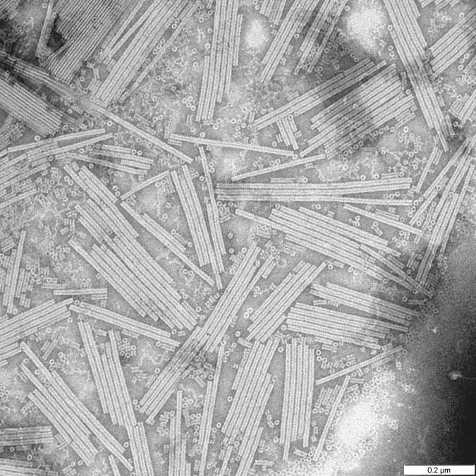 Black and white electron micrograph showing dozens of straight rod-shaped tobacco mosaic virus particles scattered at random angles, with a 0.2 micrometre scale bar.